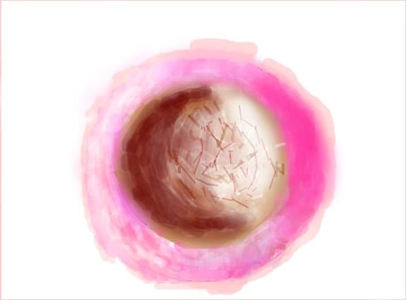 cup