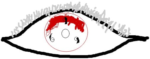 sharingan