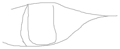 ngfvc