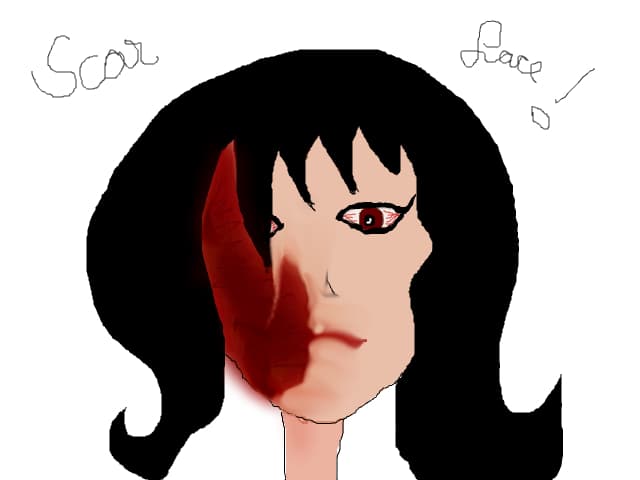 scar