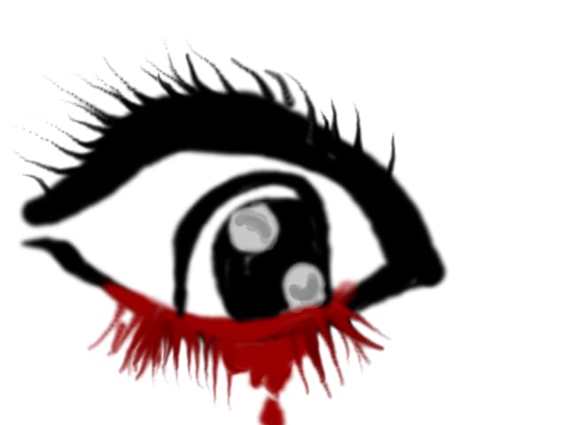 bloody eyes
