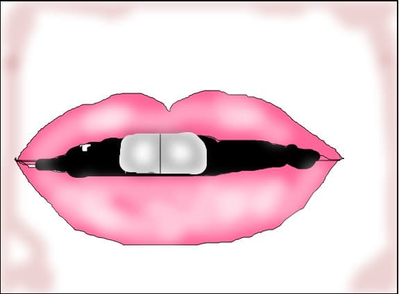 Kiss
