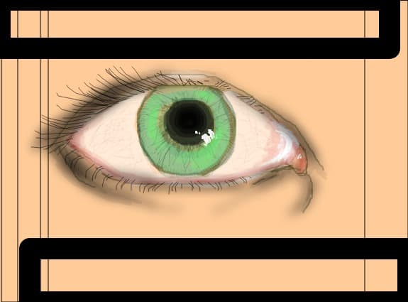 Eye...