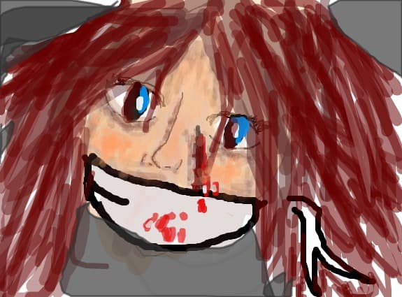 hurt