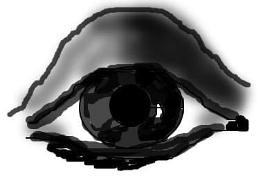 Black Eye