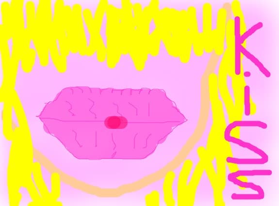 kiss