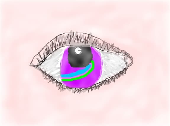 ochi