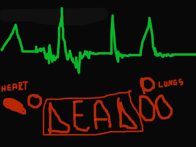 Pulse