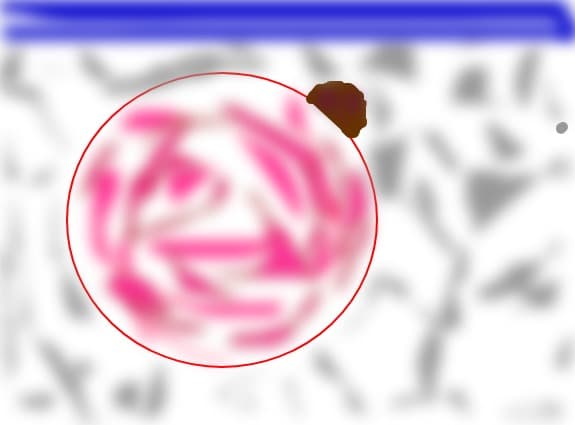 globulete