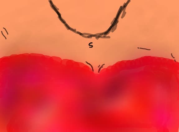 lantisor