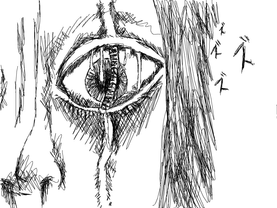Eye