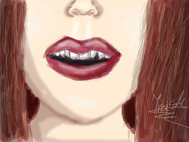 Botox