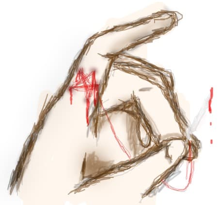 Pain in my finger