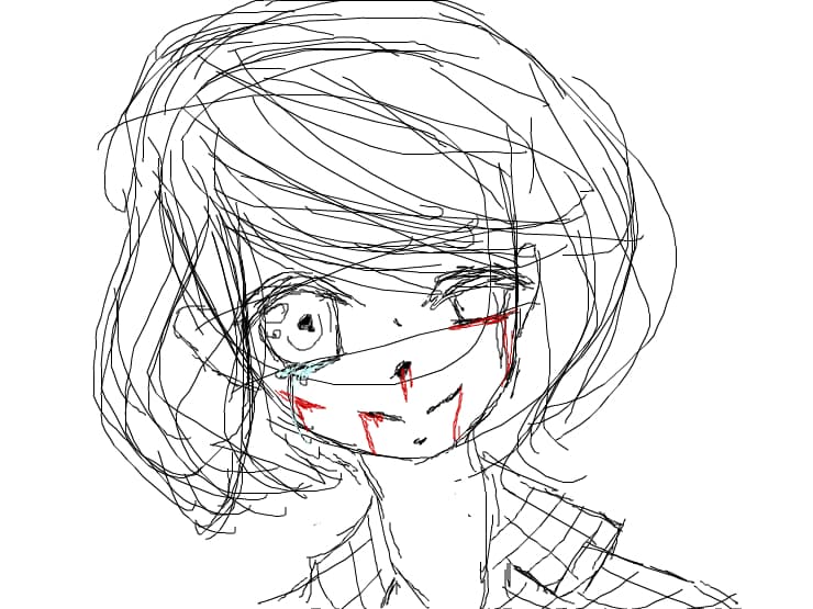 Stitches