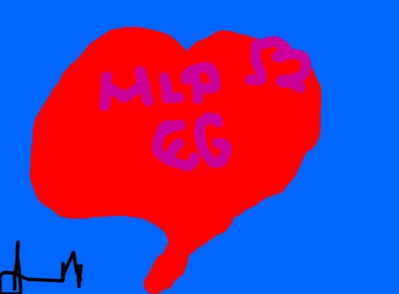 I Love MLP Eg