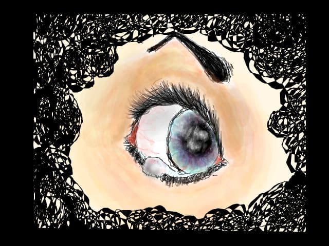 Eye