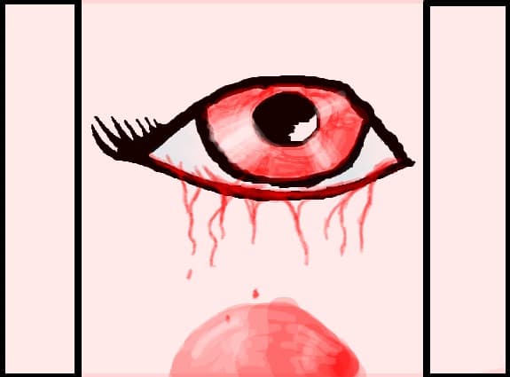 red eyes blood