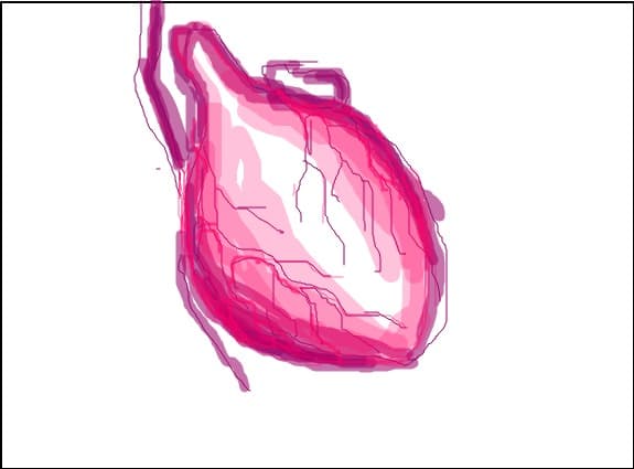 De Corazon