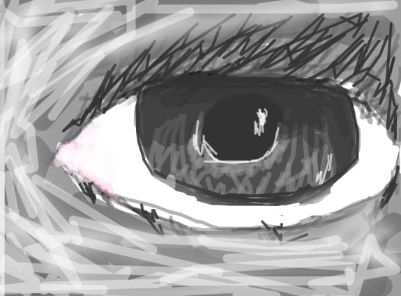 black eye