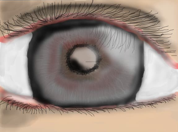 Eye