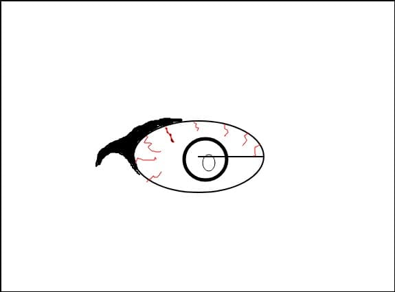 realistik eye