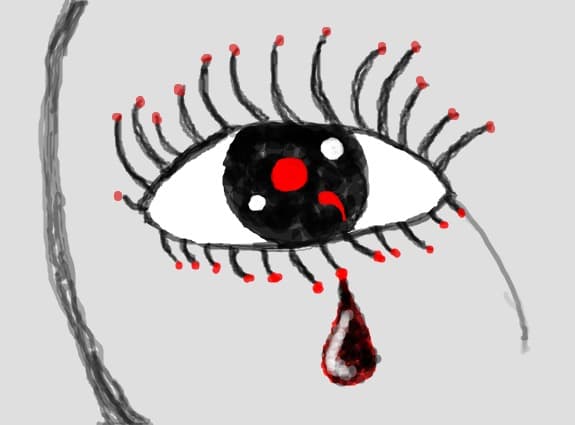 Eye