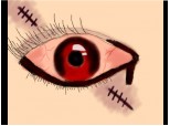 blood eye